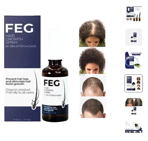 🌟 FEG Hair Growth Spray 🌟